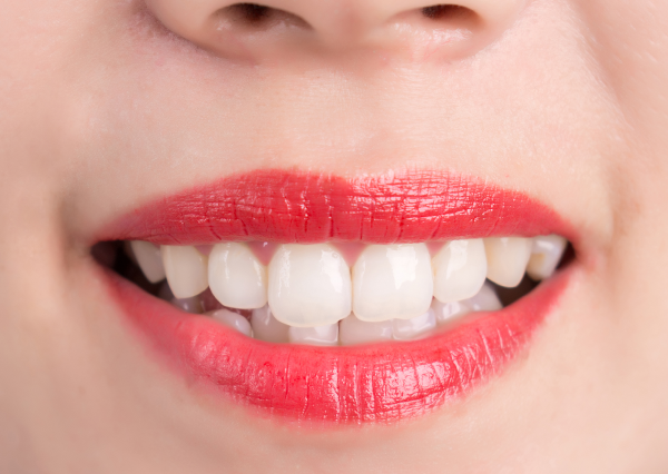 Gums